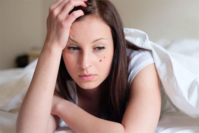 Dễ bị nội mụn khi nằm sấp